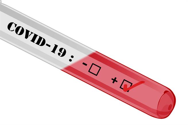 Турецкими учеными создан прибор, выявляющий носителей коронавируса за 10 секунд