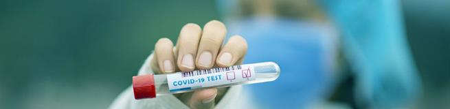 Отрицательный тест на вирус - условие путешествия в Турцию до весны 2021 года